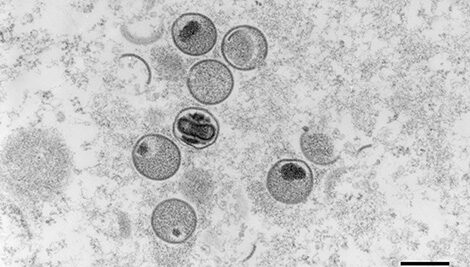 Affenpockenvirus