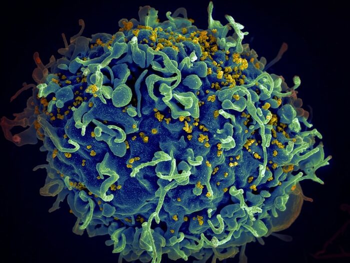 Wie das HI-Virus (gelb markiert) die menschliche Zelle infiziert.