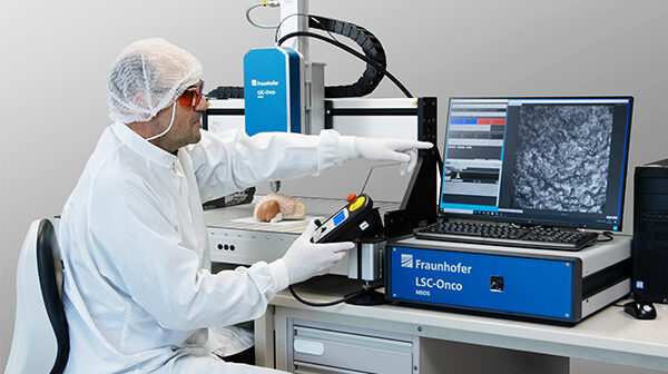 Laser-Scanning-Mikroskop zur Tumorabgrenzung